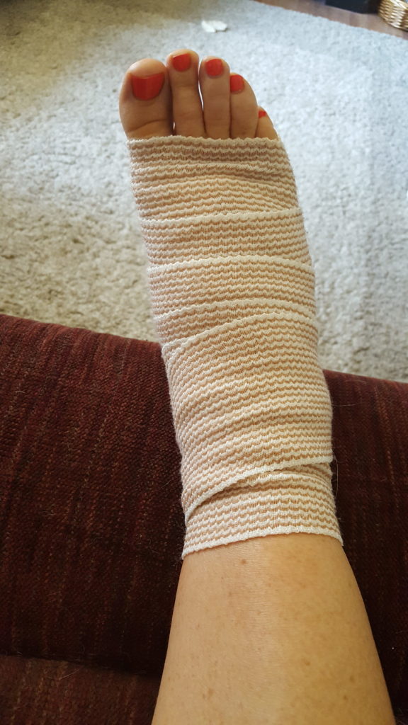 Plantar Fasciitis Surgery Photo