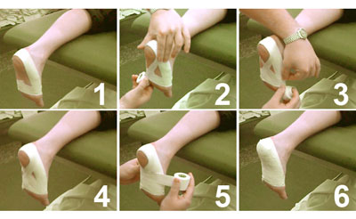 Plantar Fasciitis Foot Taping Diagram