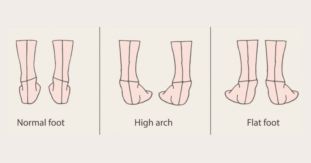 Shoes for arch type